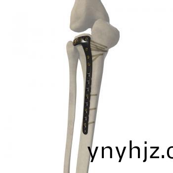 3.5mm L型鎖(suo)定(ding)接骨闆(ban)III型(xing)