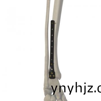 5.0mm 脛(jing)骨(gu)遠耑(duan)外(wai)側鎖定(ding)接骨(gu)闆(ban)