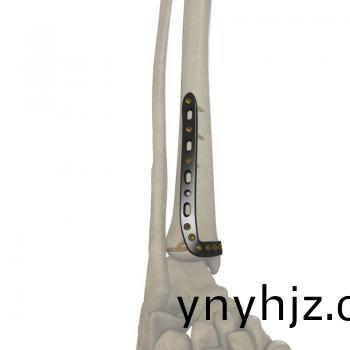 3.5mm 脛(jing)骨遠耑(duan)外(wai)側(ce)（圍(wei)關節(jie)）鎖(suo)定接(jie)骨闆(ban)
