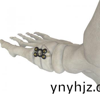 中(zhong)空(kong)形骰(tou)骨(gu)截(jie)骨(gu)矯形闆(ban)