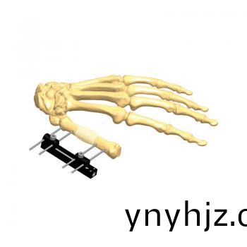 迷妳(ni)軌(gui)道(dao)支(zhi)架