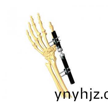 腕關(guān)節(jié)支架(jia)