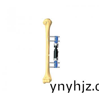 兒(er)童支(zhi)架