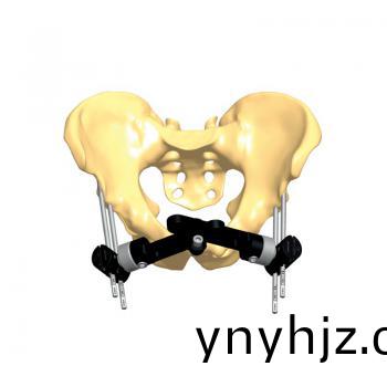 骨盆支(zhi)架(jia)