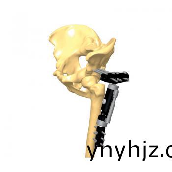 大T型(xing)下(xia)肢支(zhi)架(jia)