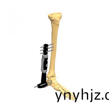踝(huai)關(guan)節支(zhi)架