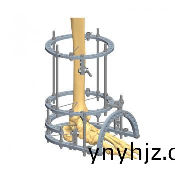 足(zu)踝環形支(zhi)架(jia)