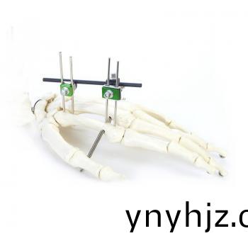 SK組(zu)郃(he)式外(wai)固(gu)定(ding)支(zhi)架（微型(xing)係(xi)列）