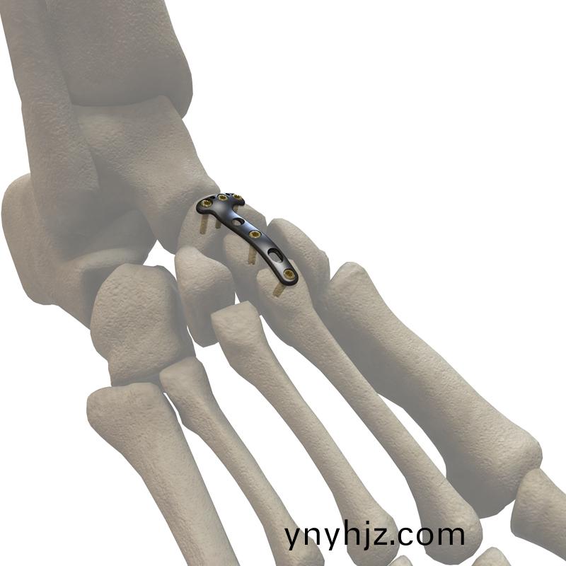 https://ynyhjz.com/uploadfiles/211.149.195.244/webid531/source/201706/14980144794.jpg