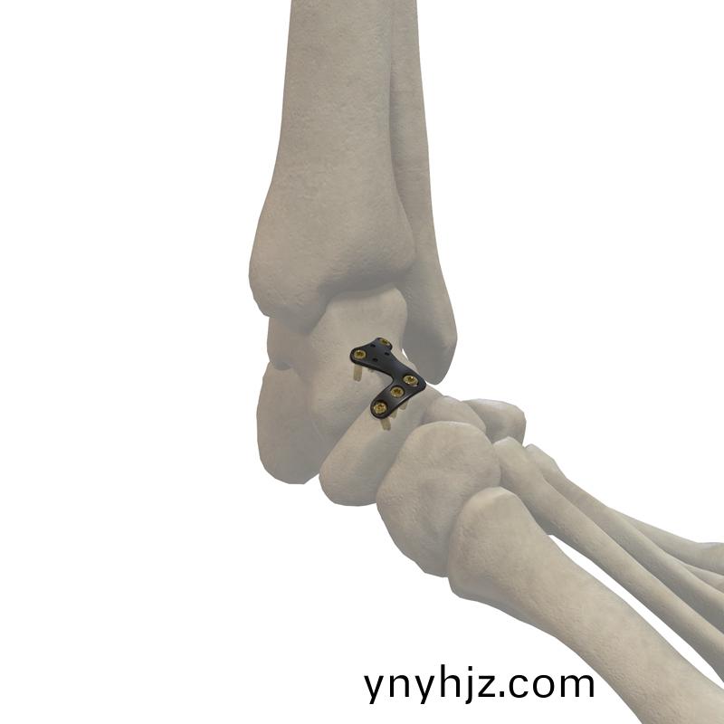 https://ynyhjz.com/uploadfiles/211.149.195.244/webid531/source/201706/149801459561.jpg